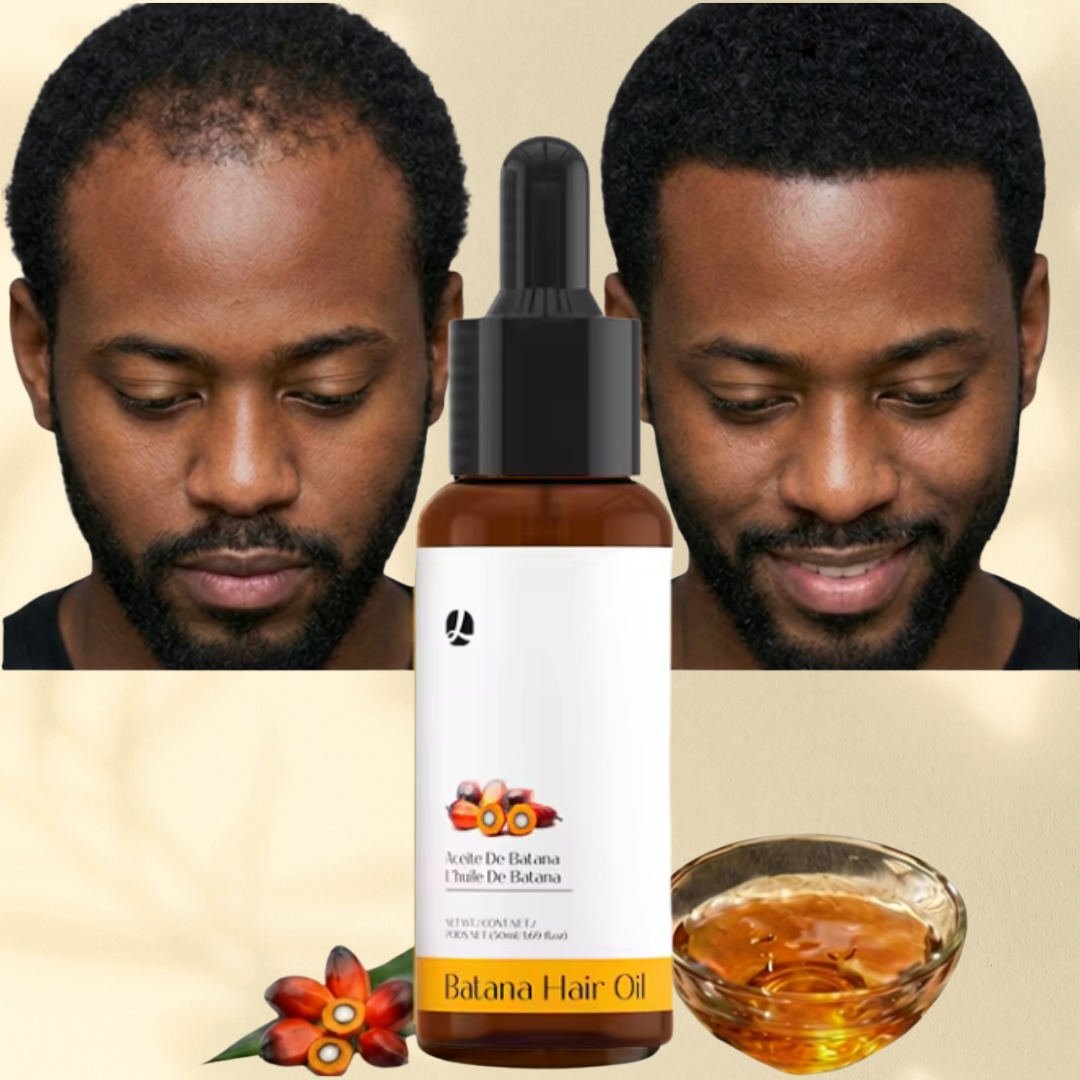 Huile de BATANA · la solution 99% naturelle pour la calvitie